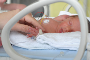 social security for premature infants